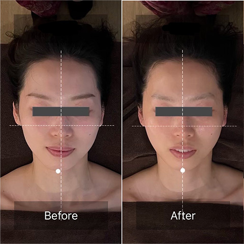 左右差の解消、引き上り