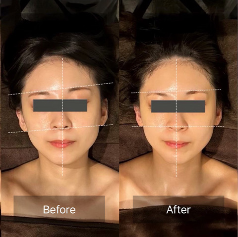 お顔の左右差が解消した女性