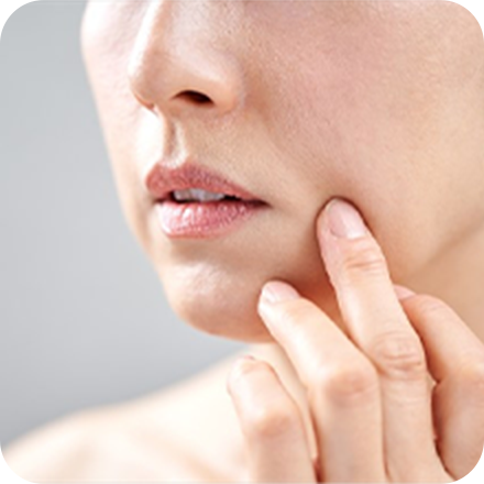 フェイスラインのたるみ、ほうれい線が気になる女性